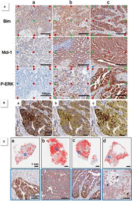 Impact of automated methods for quantitative evaluation of immunostaining: Towards digital pathology